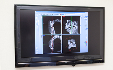 歯科用CT