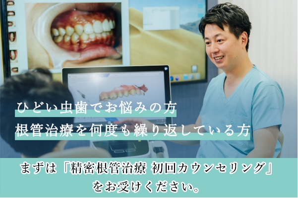 ひどい虫歯でお悩みの方 根管治療を何度も繰り返している方 まずは「精密根管治療 初回カウンセリング」をお受けください。｜東京 目白の歯医者 目白マリア歯科