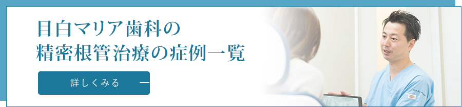 目白マリア歯科の精密根管治療の症例一覧｜東京 目白の歯医者 目白マリア歯科