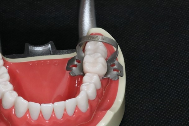 目白マリア歯科_コラム_ラバーダム防湿の器具と有用性（院長宮澤）_ラバーダムを装着するためのクランプを歯の模型に装着した画像
